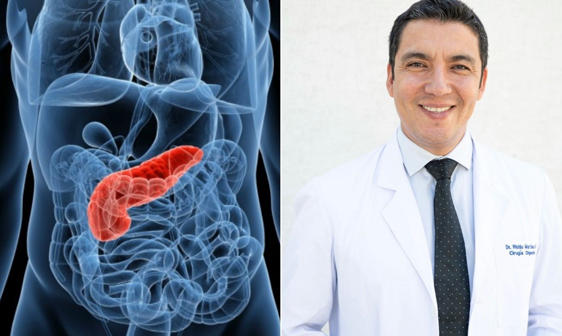 Presidente del Club de Páncreas de Chile advierte importante incremento en el cáncer de páncreas en los próximos años 